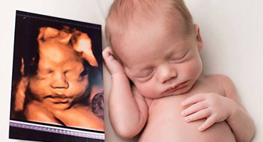 Ecografía Digital 5D